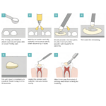 ifil workflow