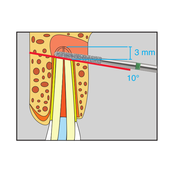 edenta d254 diagram